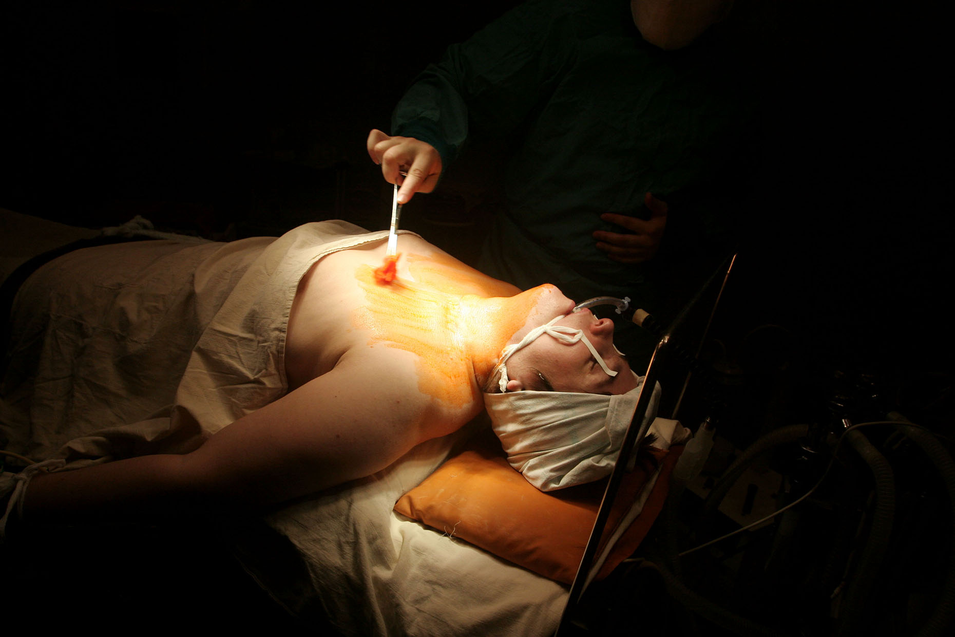 011_operation